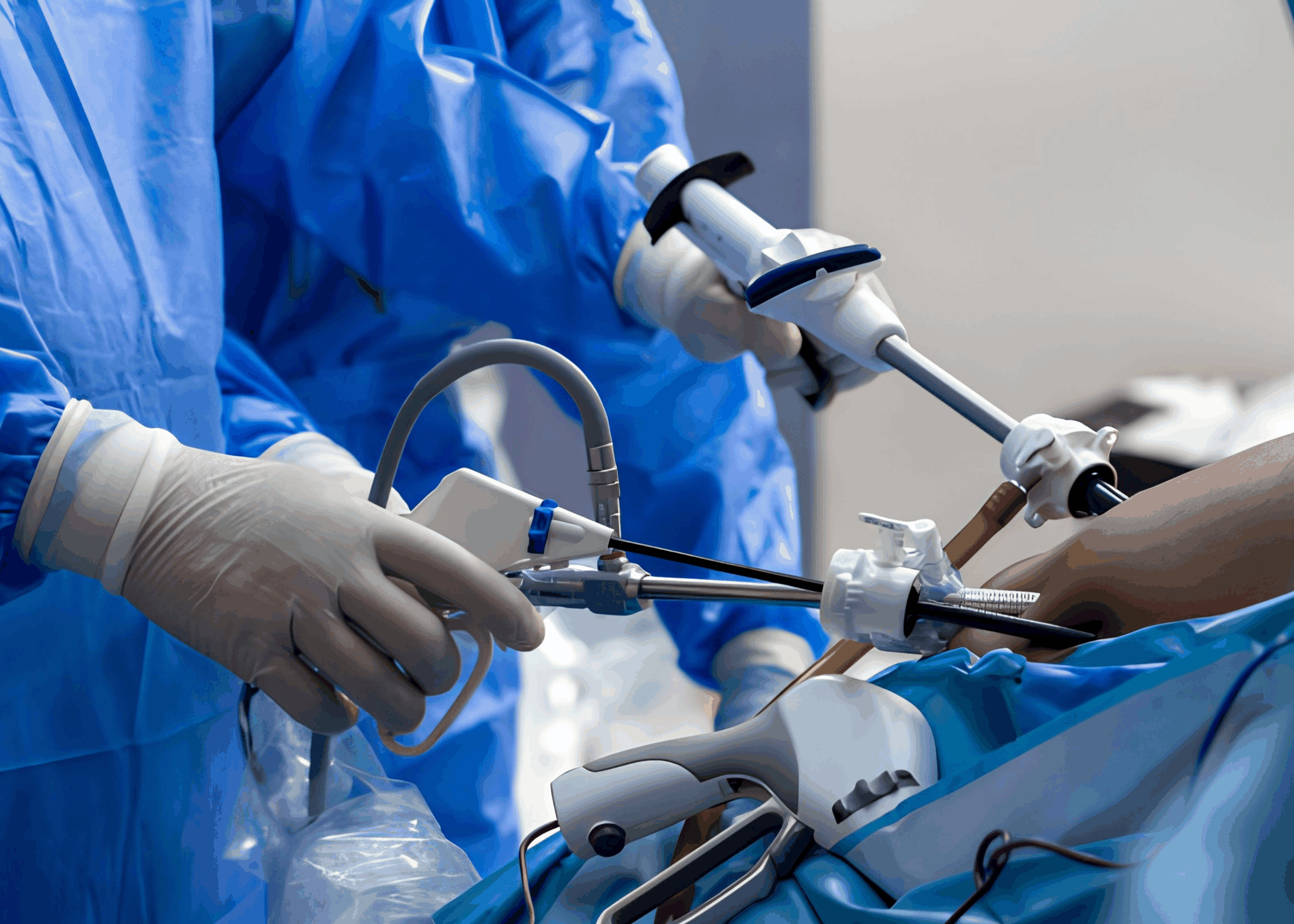 Laparoscopy